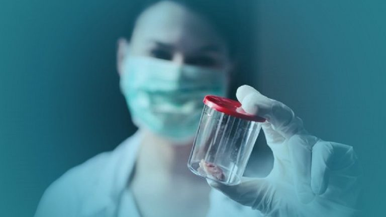 Lee más sobre el artículo Tipos de biopsia que se practica en la actualidad