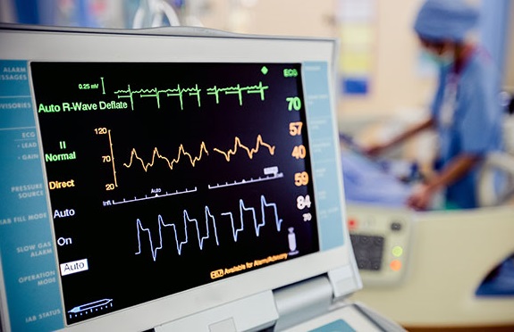 Monitorización Y Electrocardiográfos